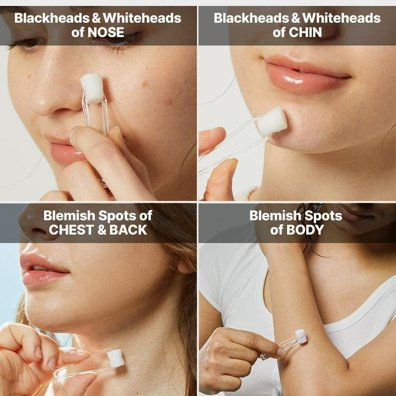 COSRX The AHA 2 BHA 2 Blemish Treatment Serum