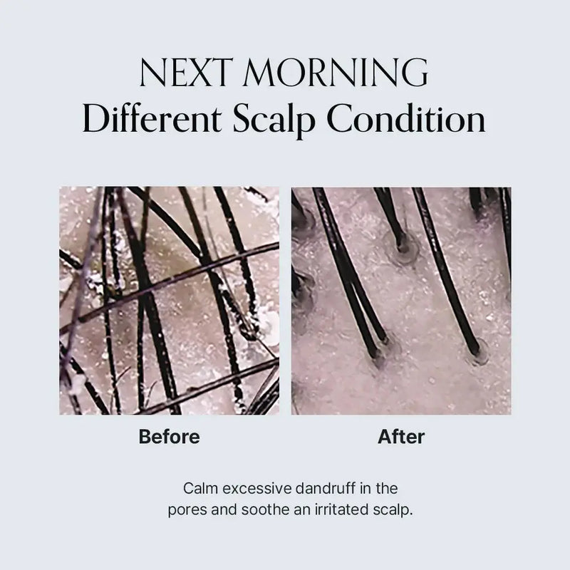 GROWUS Damage Therapy Scalp Scaling Ampoule