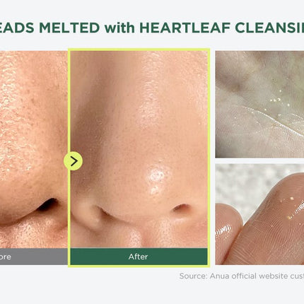 Anua Heartleaf Pore Control Cleansing Oil 20 ml.