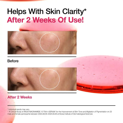 Anua Niacinamide 10% + TXA 4% Serum 10 ml.