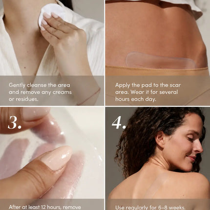Apricot Beauty Scar Pads Aloe Vera