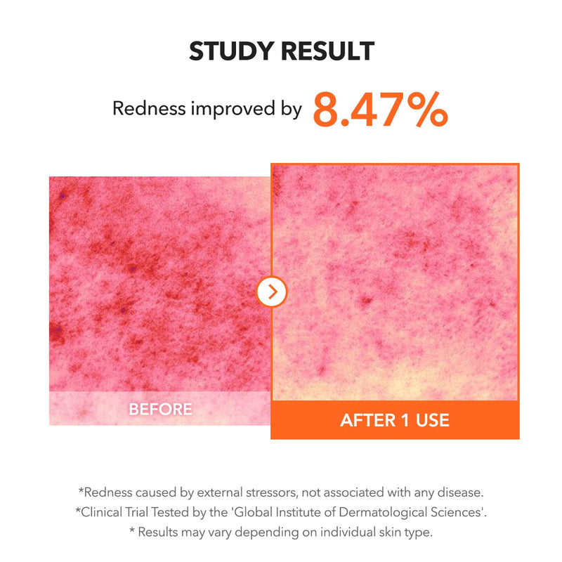 APRILSKIN Carrotene IPMP Clearing Solution