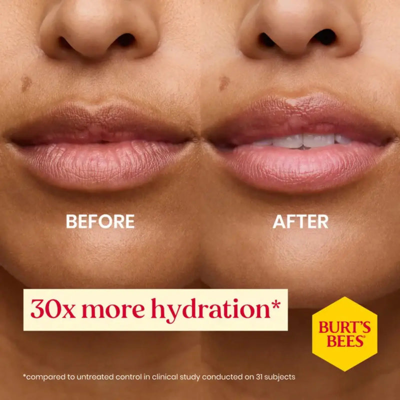Burt's Bees Lip Balm Ultra Conditioning