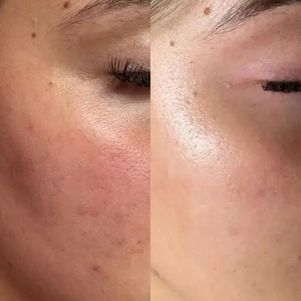 Clay And Glow 10% Niacinamide Treatment Serum