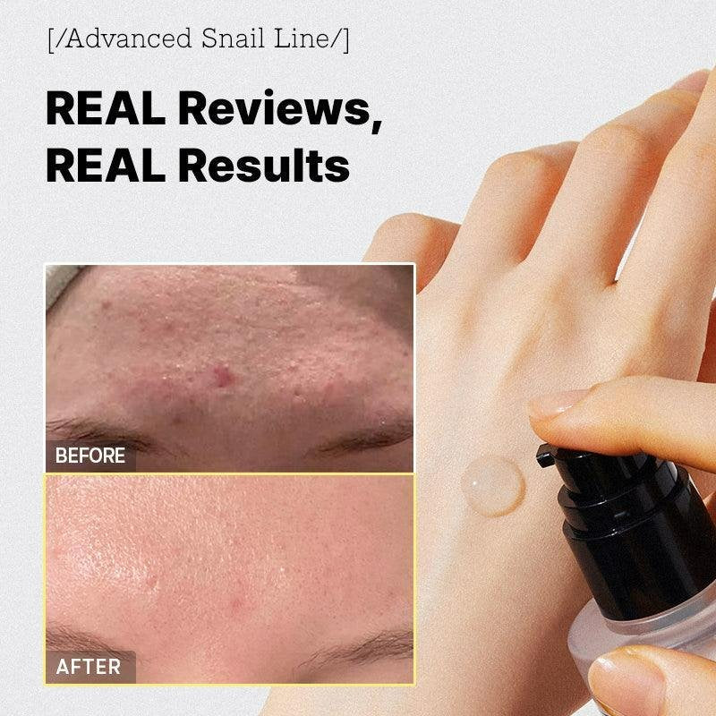 COSRX Advanced Snail96 Mucin Power Essence