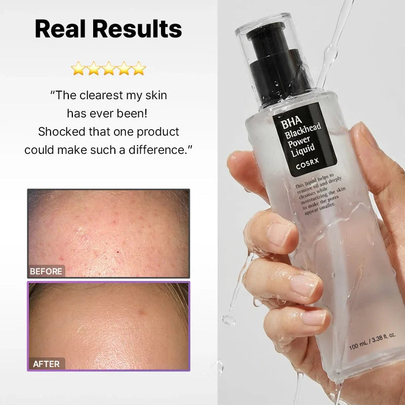 COSRX BHA Blackhead Power Liquid