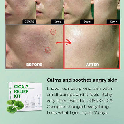 COSRX CICA-7 Relief Kit