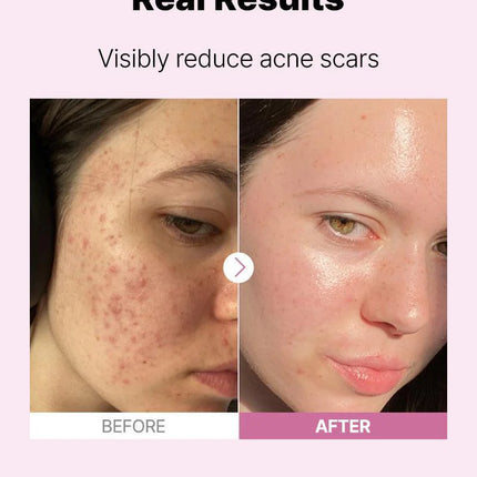 COSRX The Niacinamide 15 Serum