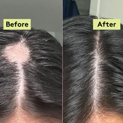 Delhicious Rich Roots Hair & Scalp Oil Amla & Rosemary 50 ml