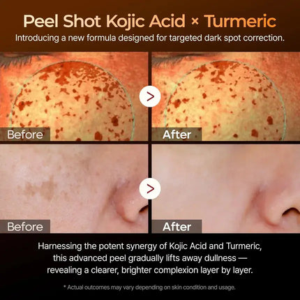 Dr.Melaxin Peel Shot Exfoliating Kojic Acid Turmeric Serum