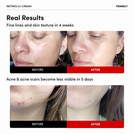 FRANKLY Retinol 0.1% Cream