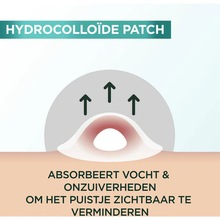 Garnier Skincare PureActive Pimple Patch