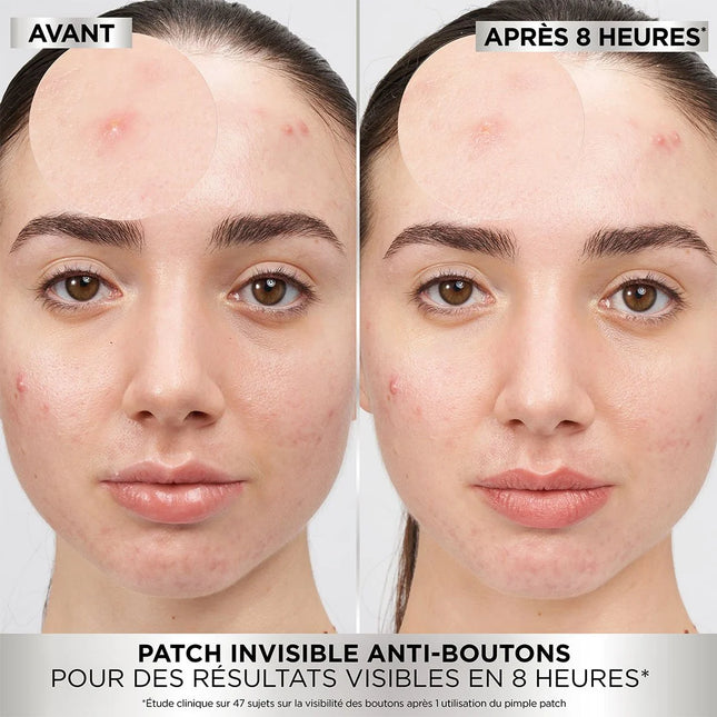 Garnier Skincare PureActive Pimple Patch