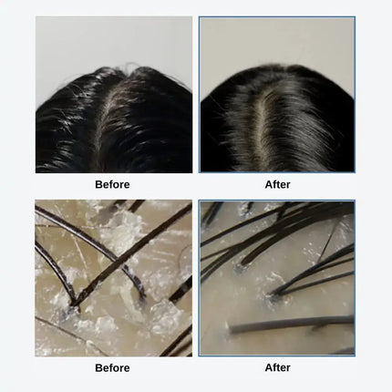 GROWUS GROWUS Sea Salt Therapy Scalp Scaler Jumbo