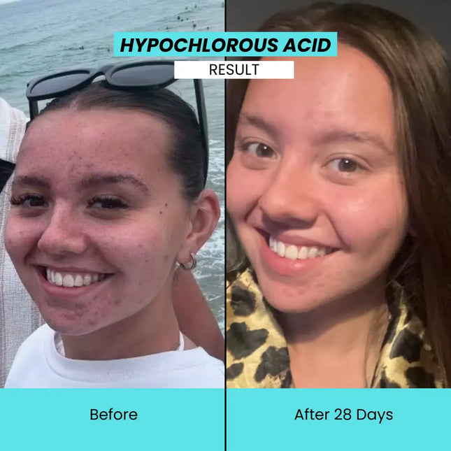 Kanzen Cleansing Antibacterial Water 30 ml.