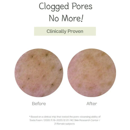 Ma:nyo Deep Pore Cleansing Soda Foam