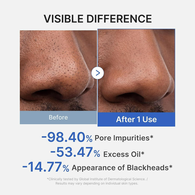Medicube ZERO PORE Blackhead MUD Mask, diepreinigend kleimasker tegen mee-eters en onzuiverheden